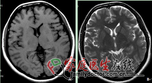 CT檢查、X線檢查等常用醫學影像學檢查方法的價值和局限