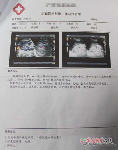 看肝病去正規(guī)醫(yī)院 2例被騙肝病患者真實(shí)案例