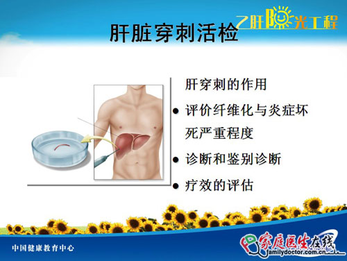 肝炎檢查大全 教你看懂肝病所有檢查項目