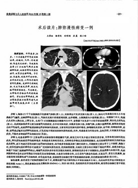 《影像診斷與介入放射學》簡介